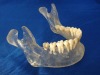 Mandible Model