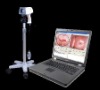 Colposcope Digital Imaging System