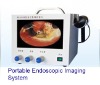 ENDOSCOPE