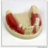 implant tooth practice study model