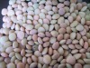 Chinese Lentil